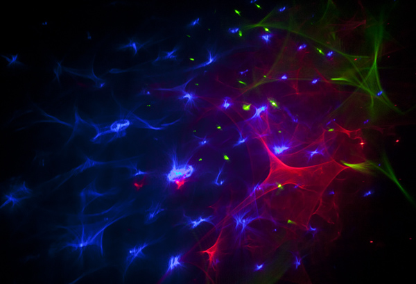 LisForLaser_13
